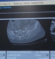 Crack.jpg