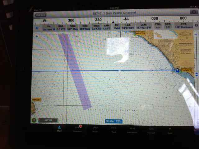 All electronic information is wirelessly sent to my iPad where we can also do all electronic charting